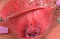 Free Gape My Pussy Trials s0